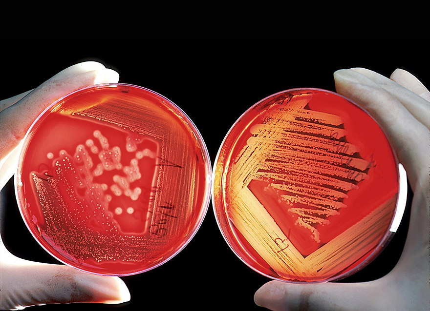 Bis 2050 könnten laut einer OECD-Studie rund 2,4 Millionen Menschen durch Bakterien sterben, gegen die kein Antibiotikum mehr wirkt