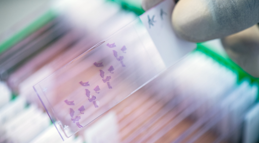 Gefärbte Knochenmark-Fragmente auf einem Objektträger: Im TRR 387 UbiQancer sollen neue Erkenntnisse über die Funktion des Ubiquitin-Systems bei bestimmten Krebsarten gewonnen werden (© Andreas Heddergott/TUM)
